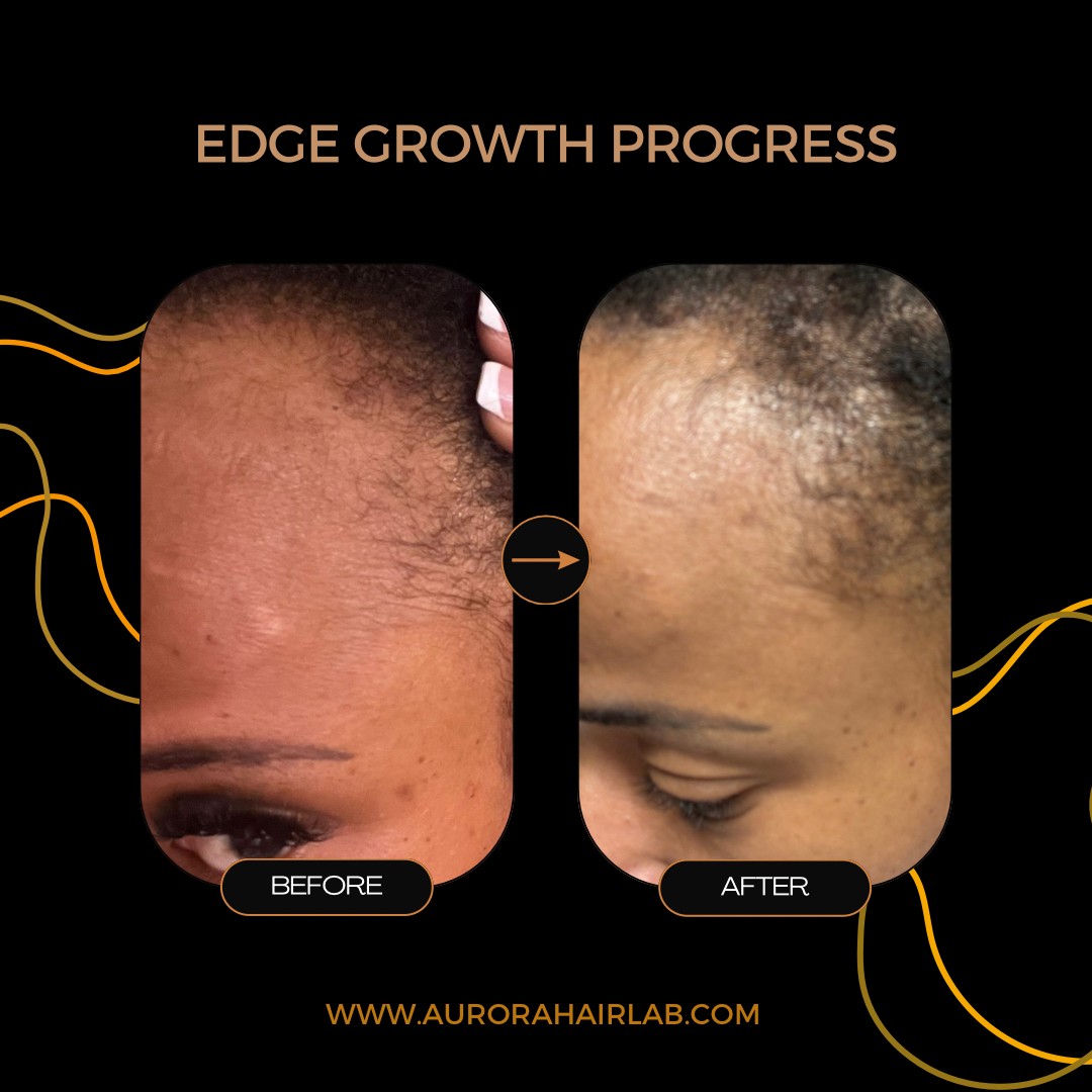 The Edge & Scalp Growth Bundle