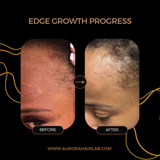 The Edge & Scalp Growth Bundle