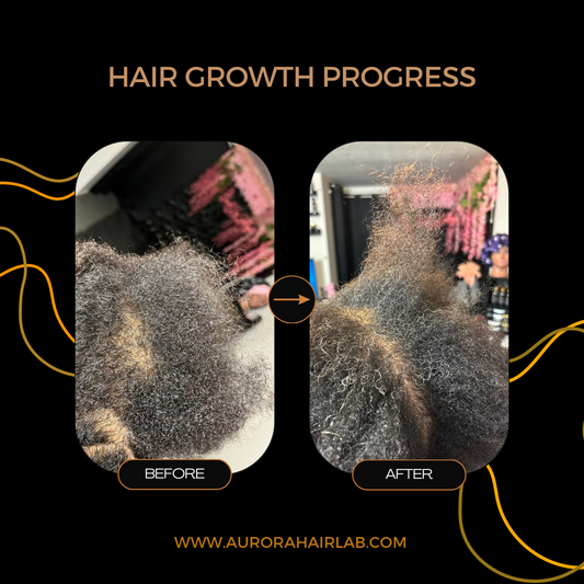 Hair growth after 6 months of using the scalp cleanse combo